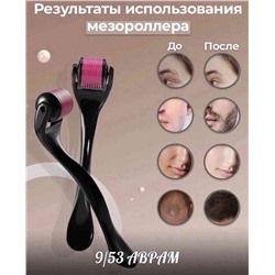 Мезороллер для лица и тела от морщин косметологический уход 1мм